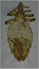 body louse